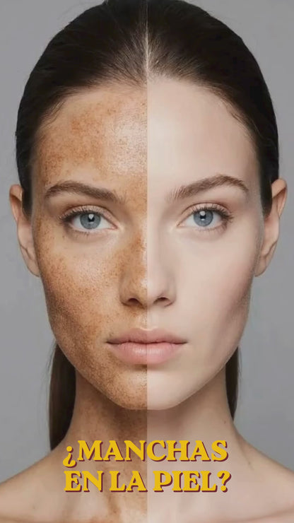 LINA Serum Ácido Tranexámico Despigmentante para Piel Luminosa y Hidratada 30ml Cuidado Facial Diario